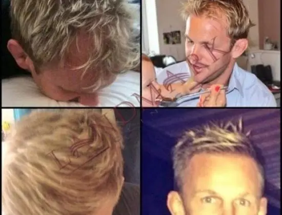 LANDMARK HAIR LOSS CLINIC