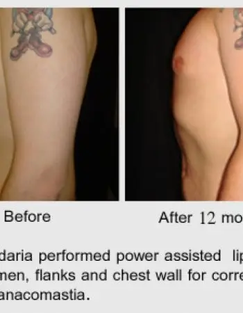 Vadodaria Cosmetic & Plastic Surgery