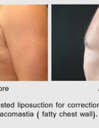 Vadodaria Cosmetic & Plastic Surgery