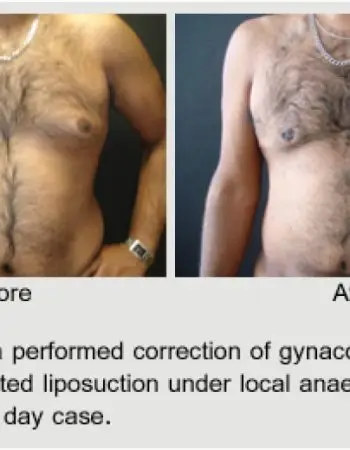Vadodaria Cosmetic & Plastic Surgery